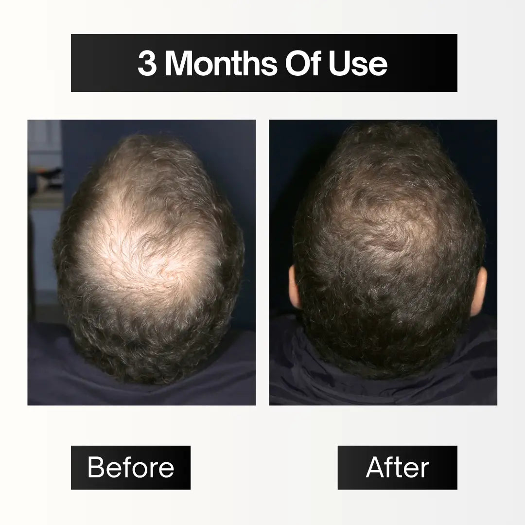 The Complete System®