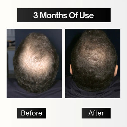 The Complete System®